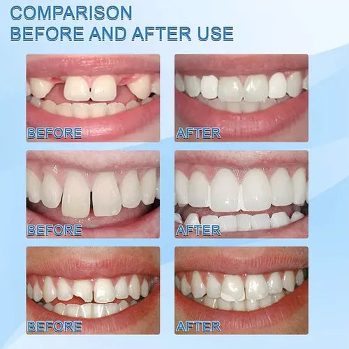 Gránulos de Reparación de Dientes - additional image 6